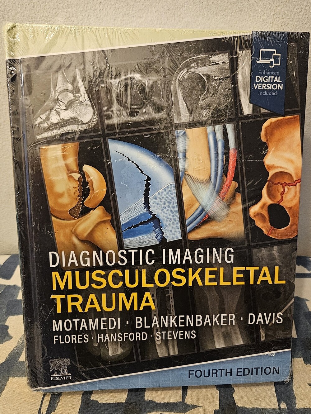 Diagnostic Imaging: Musculoskeletal Trauma Hardcover Book